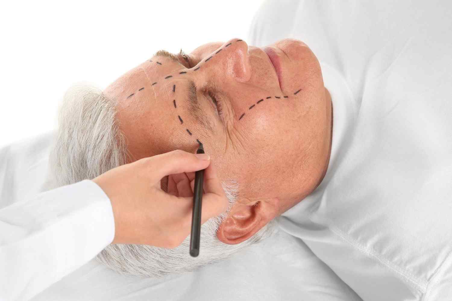 https://hollywoodhairloss.com/wp-content/uploads/2017/08/cosmetic-surgery-blog-03.jpg